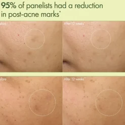 Dr Weil Mega-Mushroom Dark Spot Corrector Moisturizer
