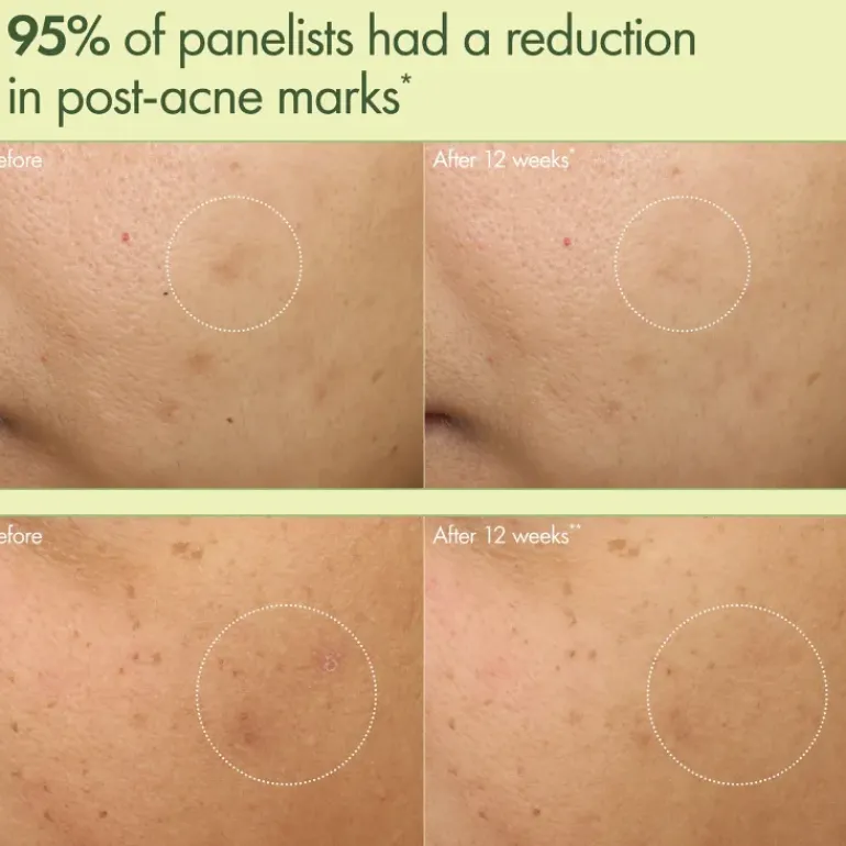 Dr Weil Mega-Mushroom Dark Spot Corrector Moisturizer